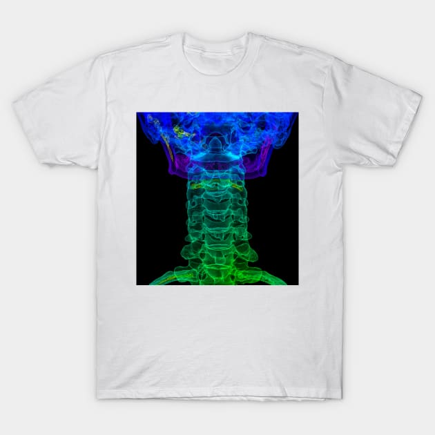 Cervical spine anatomy, 3D CT scan (C034/5265) T-Shirt by SciencePhoto